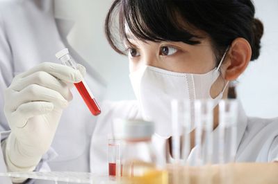 がん発見「腫瘍マーカー検査」の知られざる真実!早期発見は本当にできるのか