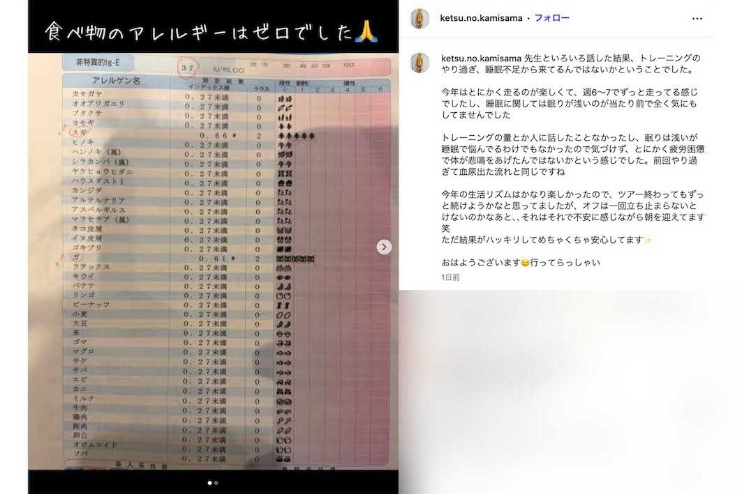 蕁麻疹の診断結果を報告したゴールデンボンバーの樽美酒研二（本人のインスタグラムより）