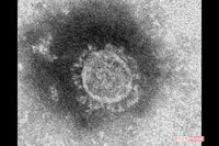 コロナ後遺症で円形脱毛症？ オミクロン陽性者にワクチンは？ 感染拡大で広がる“噂”に医師が回答