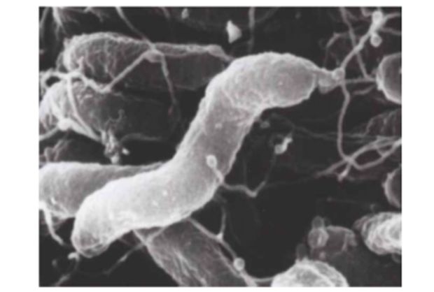 胃の表層を覆う粘液の中にすみつくというピロリ菌