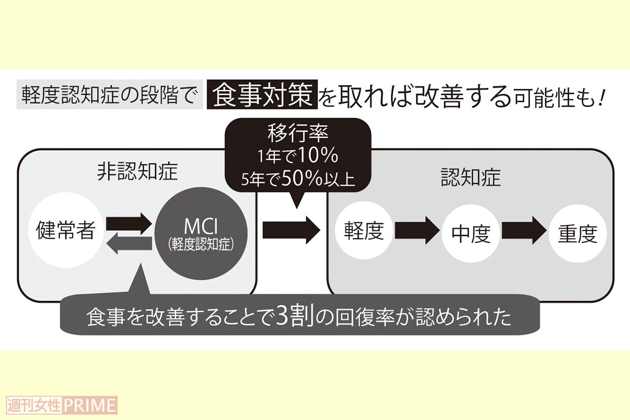 軽度認知症の段階で食事対策を取れば改善する可能性も！
