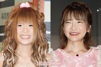 “やせている”は美なのだろうか?ギャル曽根はガチの「やせの大食い」、摂食障害に詳しい筆者が読み解く“…