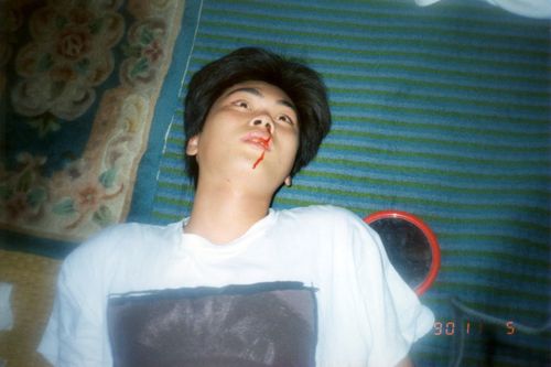 殴り合いのケンカをして気絶したり鼻血を出すことも