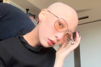 ステージ4のがんと闘う29歳のTiktoker・サイタマさん「思い切ってスキンヘッドに」明かしたイマを楽しむ“…