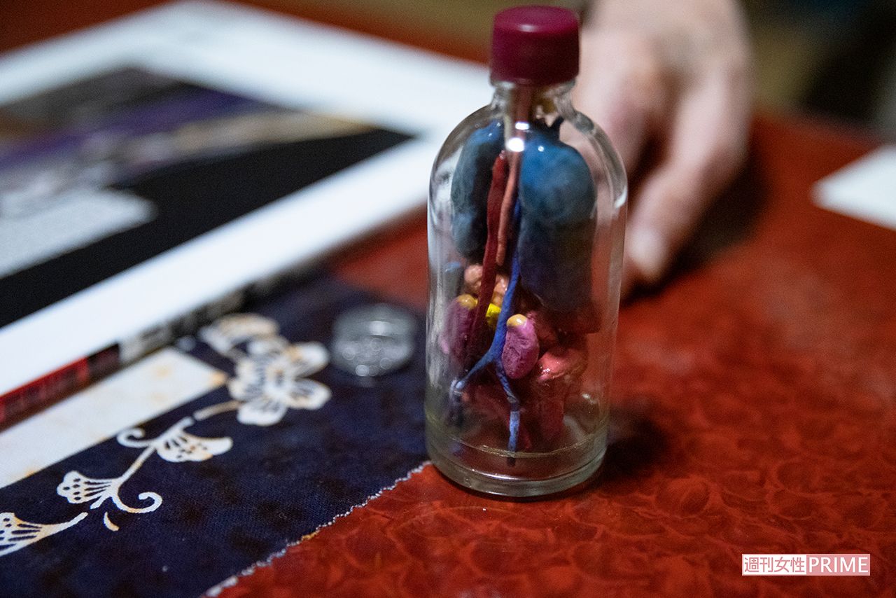 みきおさんが小学生のときに作ったという内臓入り瓶細工