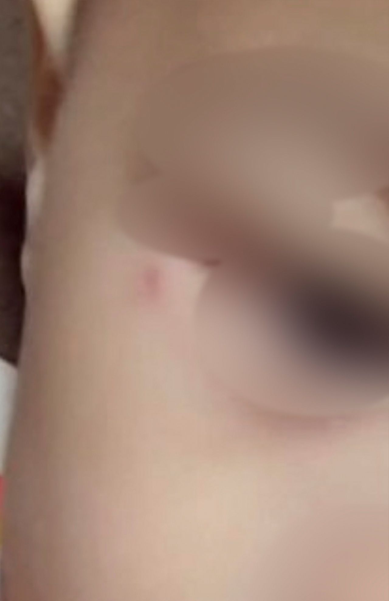 長男の顔のアップ写真。目の端に傷跡のようなはれがある（藍容疑者のツイッターより）