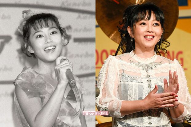 浅香唯（左は32年前）