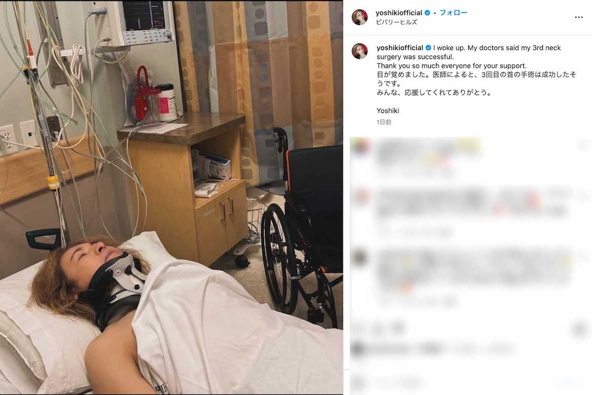 首を固定された状態でベッドに横たわる姿をアップし、《3回目の首の手術は成功》《みんな、応援してくれてありがとう》と報告したX JAPANのYOSHIKI（本人のインスタグラムより）