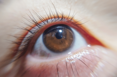 心身の不調・脳にも影響する「目の日焼け」眼科専門医が警鐘する紫外線が目にもたらす意外な“弊害”