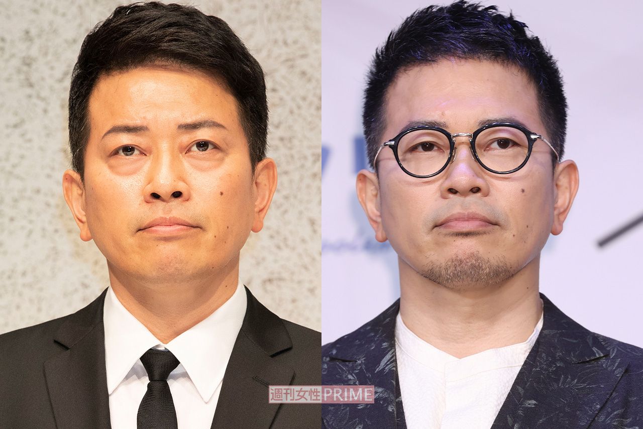 整形前（右）と、目の下のクマ除去をした宮迫博之