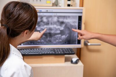 “悪徳インプラント”に警鐘！歯科業界の価格競争が深刻化「安すぎるインプラント」ホントに大丈夫？「しっ…