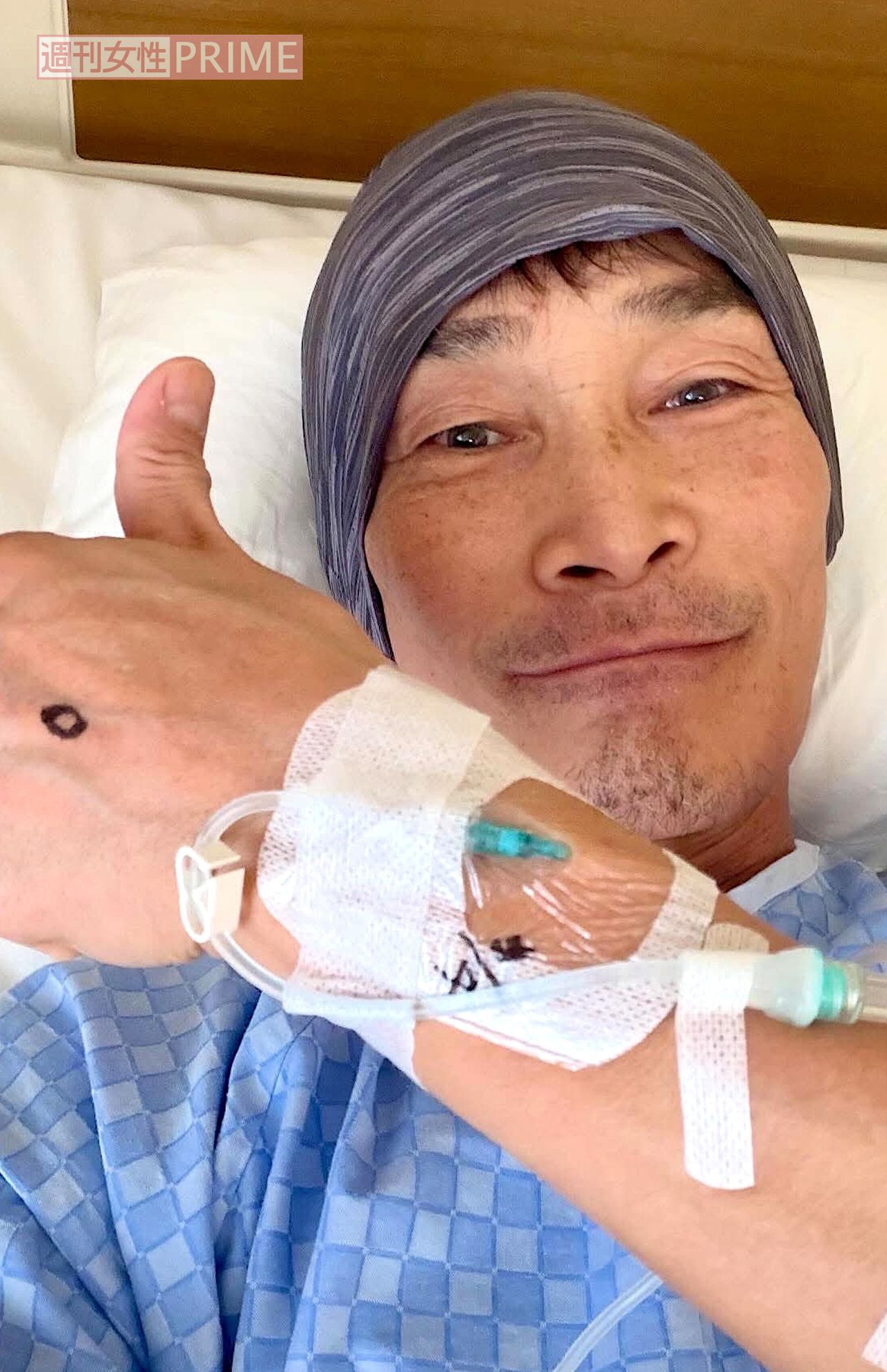露出していた骨を手術で摘出。「痛みと炎症で食事も会話も困難。がん治療の副作用よりも後遺症に苦しめられました。今はおいしく食べられる喜びを噛みしめています」　写真／杉田あきひろさん