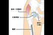 股関節の構造イメージ