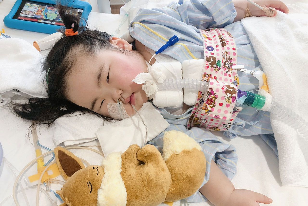 入院中の急変後の3歳半ごろの渡辺瑚々ちゃん。身体を動かせなくなり顔もむくんだ状態。欲しかったぬいぐるみと一緒に寝て安心した様子に