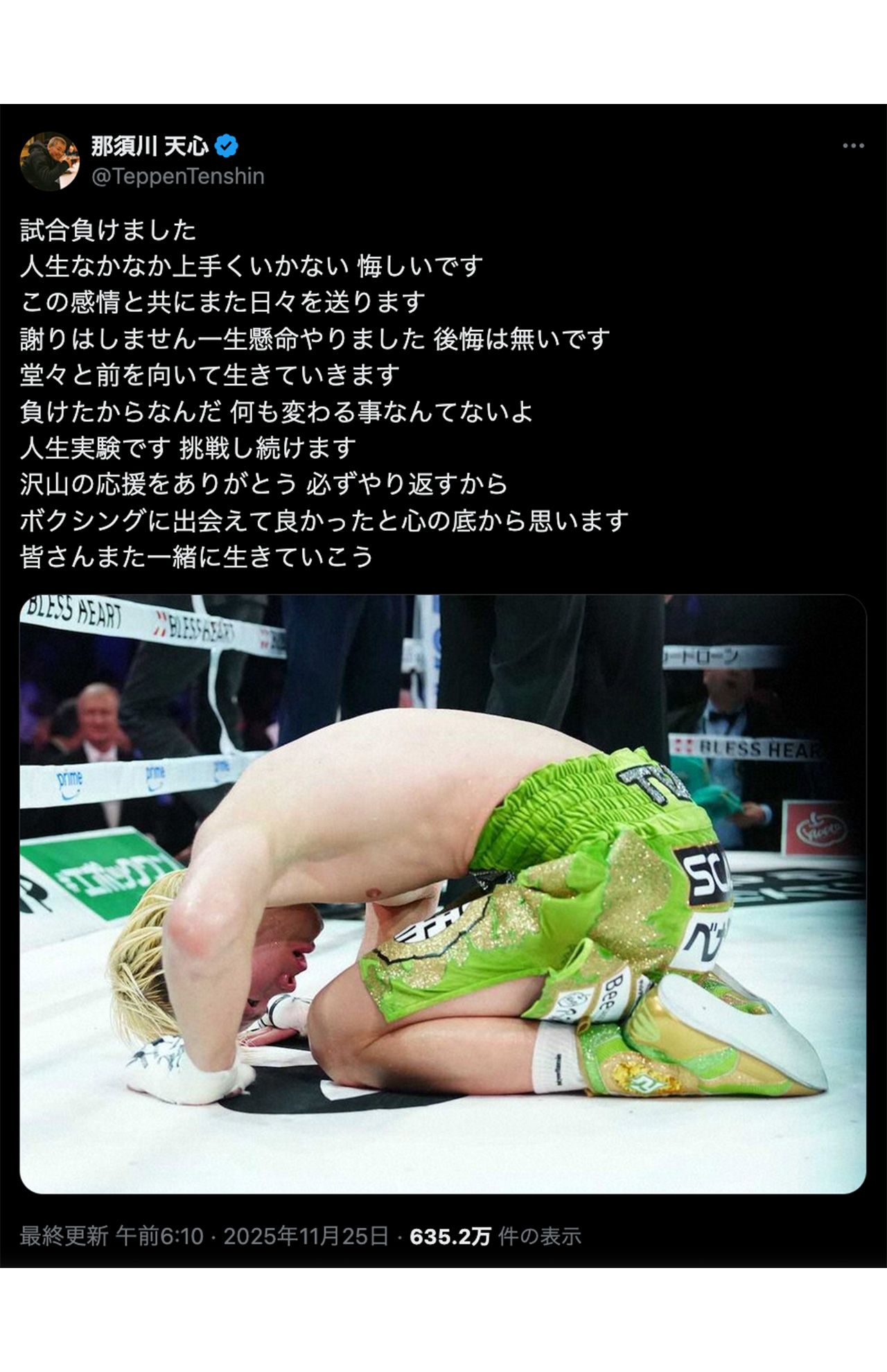 井上拓真との試合を振り返った那須川天心、各メディアでは“土下座”が報じられた（公式Xより）