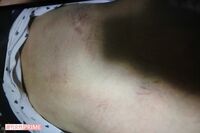 トイレ監禁に袋叩き、外国人女児の壮絶いじめに教頭・校長が言い放った言葉