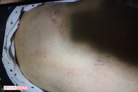 トイレ監禁に袋叩き、外国人女児の壮絶いじめに教頭・校長が言い放った言葉