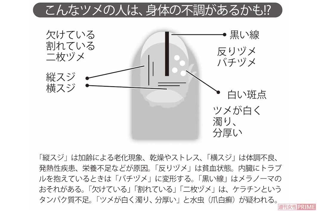 こんなツメの人は、身体の不調があるかも!?