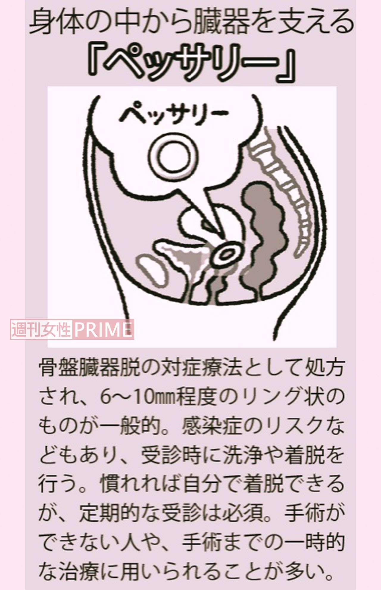 イラスト／やまだやすこ