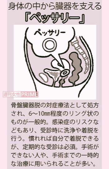 イラスト／やまだやすこ