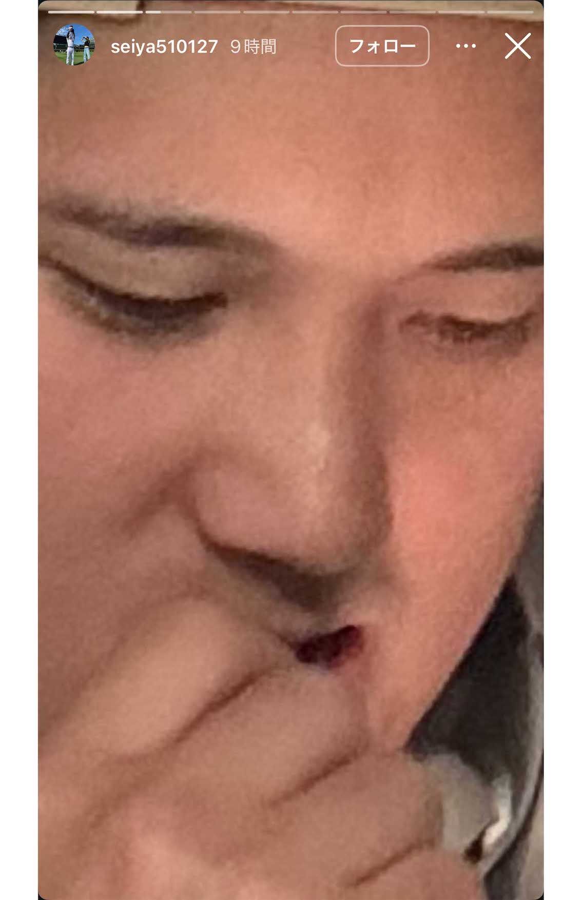 鈴木誠也が公開した大谷翔平の“どアップ”写真（鈴木のインスタグラムより）