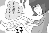 レーザー脱毛で毛が濃くなる!? 医療脱毛の素朴なギモン
