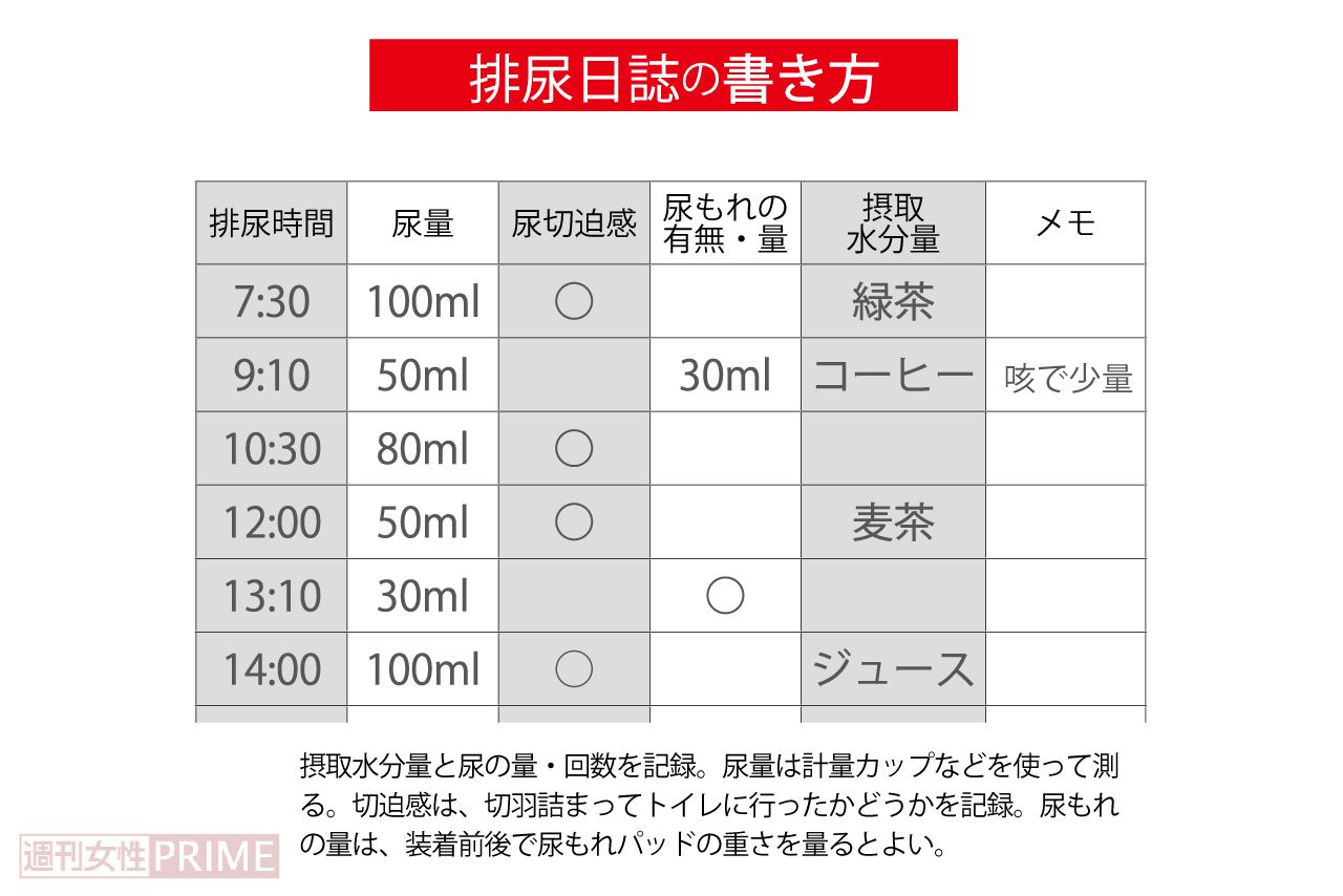 排尿日誌の書き方