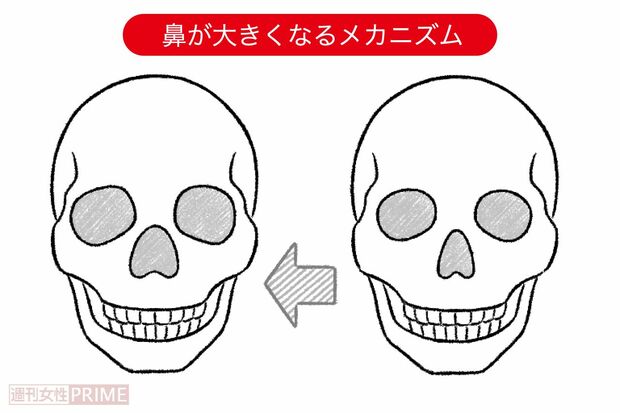 鼻が大きくなるメカニズム（イラスト／日江井香）