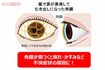 イラスト提供:現代人の角膜ケア研究室
