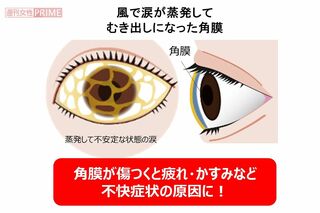 イラスト提供：現代人の角膜ケア研究室