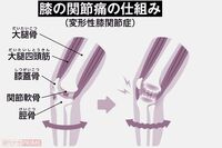 梅雨どきに気になる関節痛が男性よりも女性が2.3倍も多いのは更年期が関係、予防のキーは体重管理と筋力「…