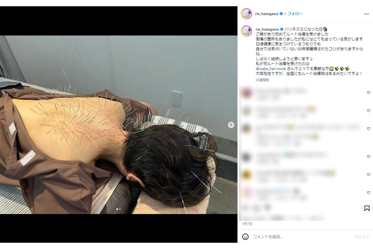 長谷川理恵は以前にもルート治療を受けていた（本人インスタグラムより）