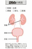 尿もれの原因