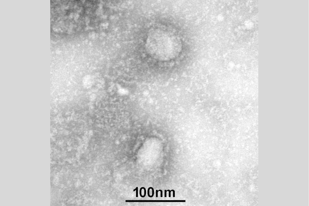 顕微鏡で撮影された新型コロナウイルス