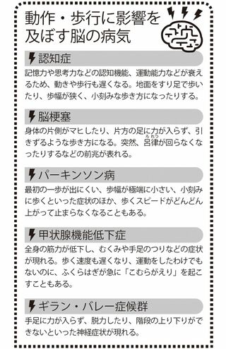 動作・歩行に影響を及ぼす脳の病気