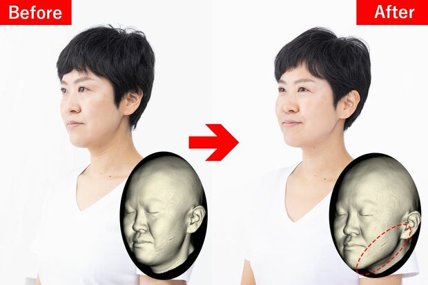 1か月実践したAさん（40代）※画像は『すぐ実感！「マイナス10歳」カオキン体操』（青志社）より