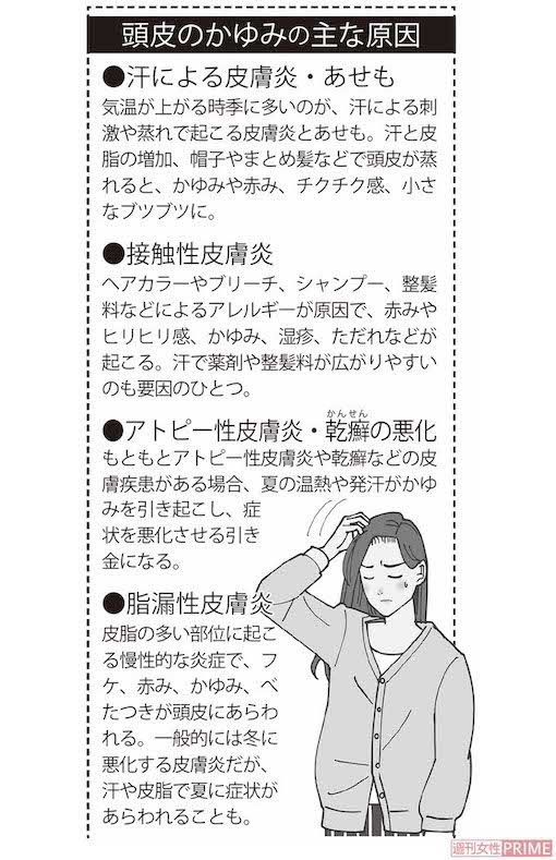 頭皮のかゆみの主な原因