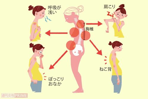 背骨の胸から腰にかけた骨がガチガチに固まって使えていないと、腰痛だけでなく、身体にあらゆる不具合を起こすことが判明！イラスト／原裕子