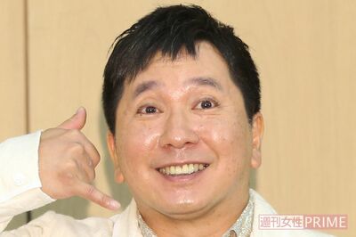 爆笑・田中裕二も発症「脳梗塞」を専門医が解説「“いつもと違う”に注意!40代から検査を」