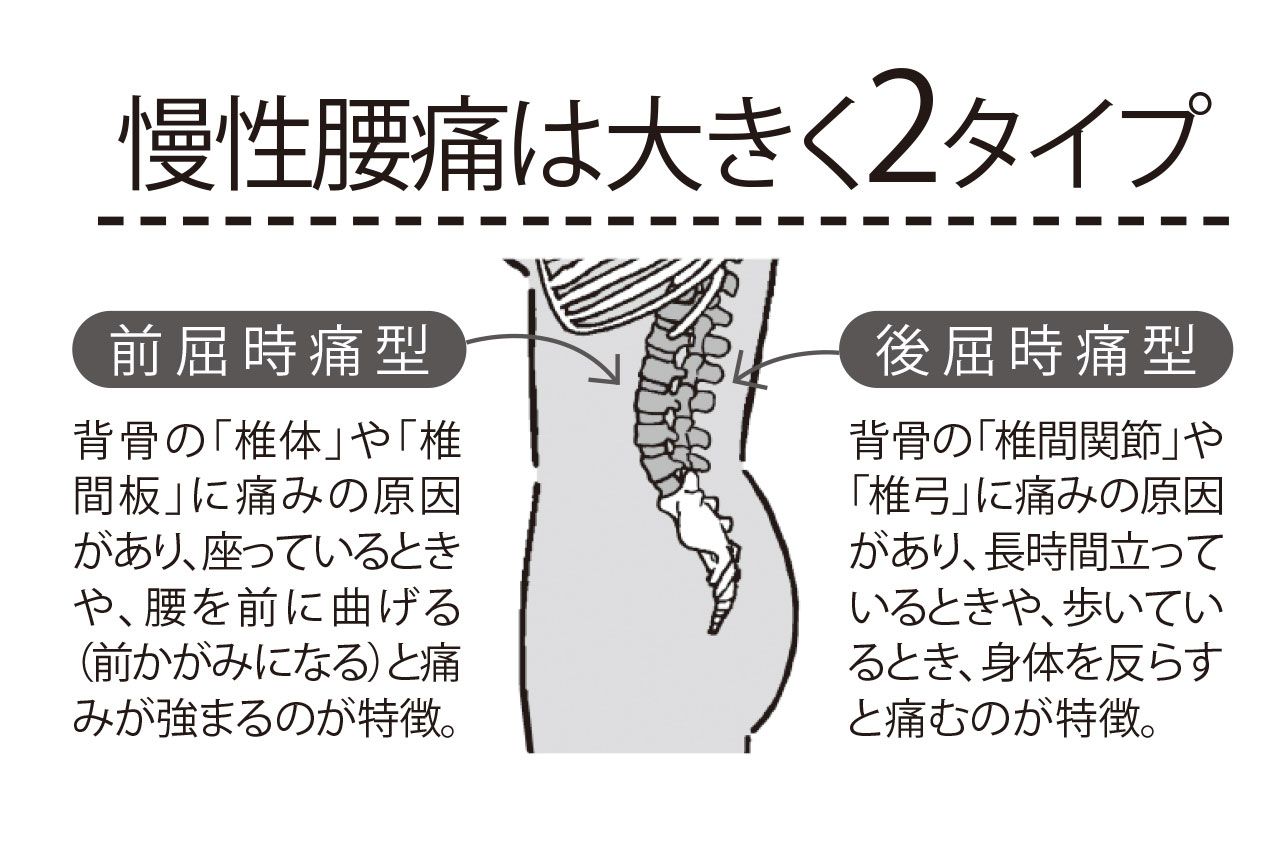 慢性腰痛の2つのタイプ