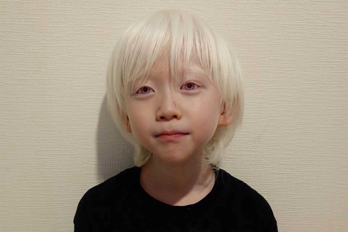 「アルビノ」を抱えているりっくん