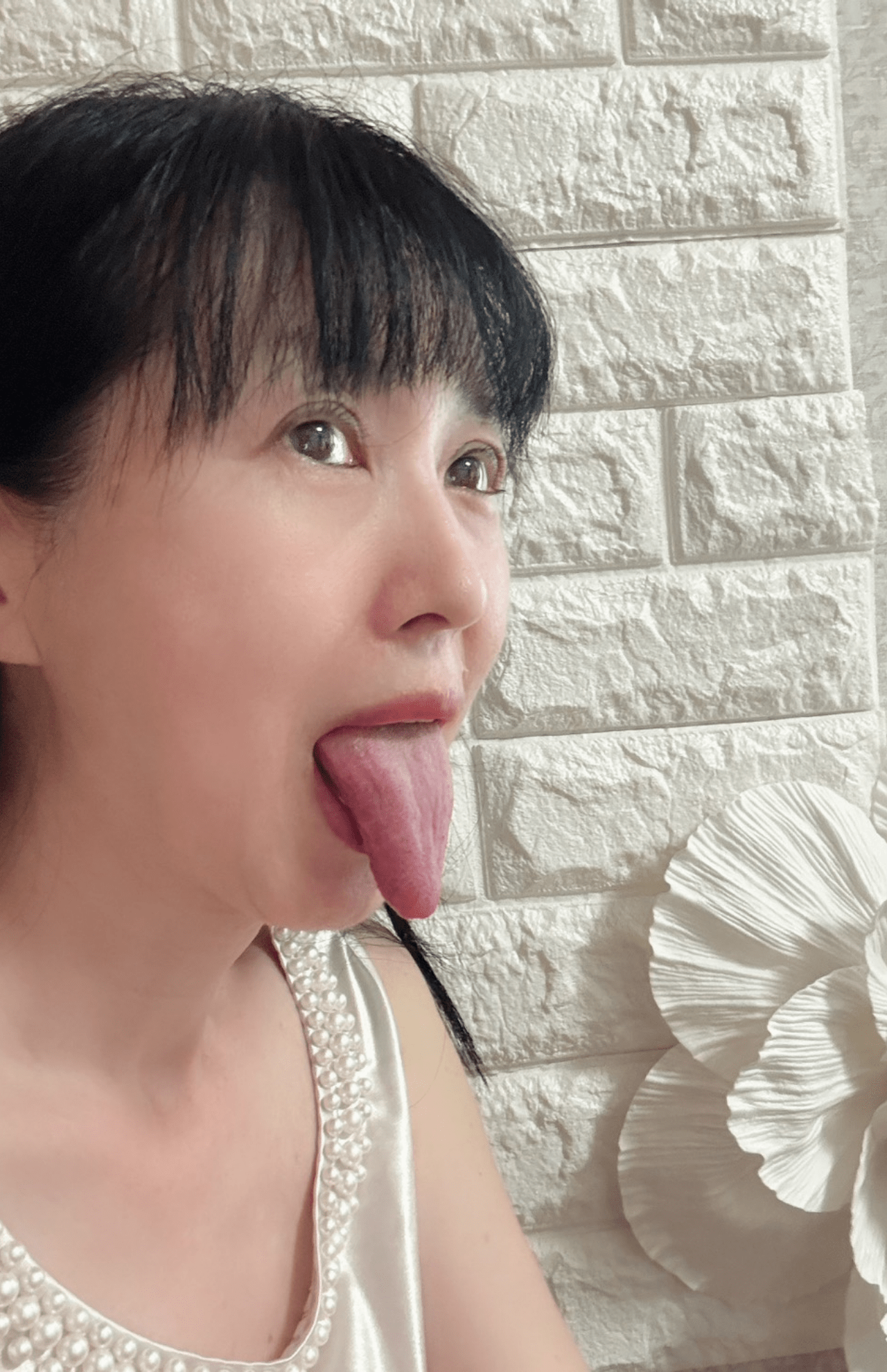 顎の骨格が小さいこと、そして舌が長いことが睡眠時無呼吸症候群の原因と指摘された西村さん。「舌が顎までいきますからね、長いんですよね……」