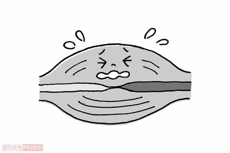 気持ちいいが筋線維や血管にダメージが（イラスト／伊藤和人）