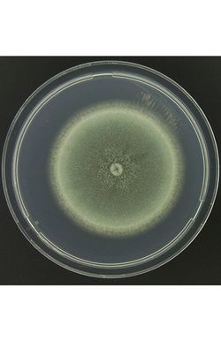 シャーレで培養したアスペルギルス菌。この菌が感染症の原因に　提供／千葉大学真菌医学研究センター
