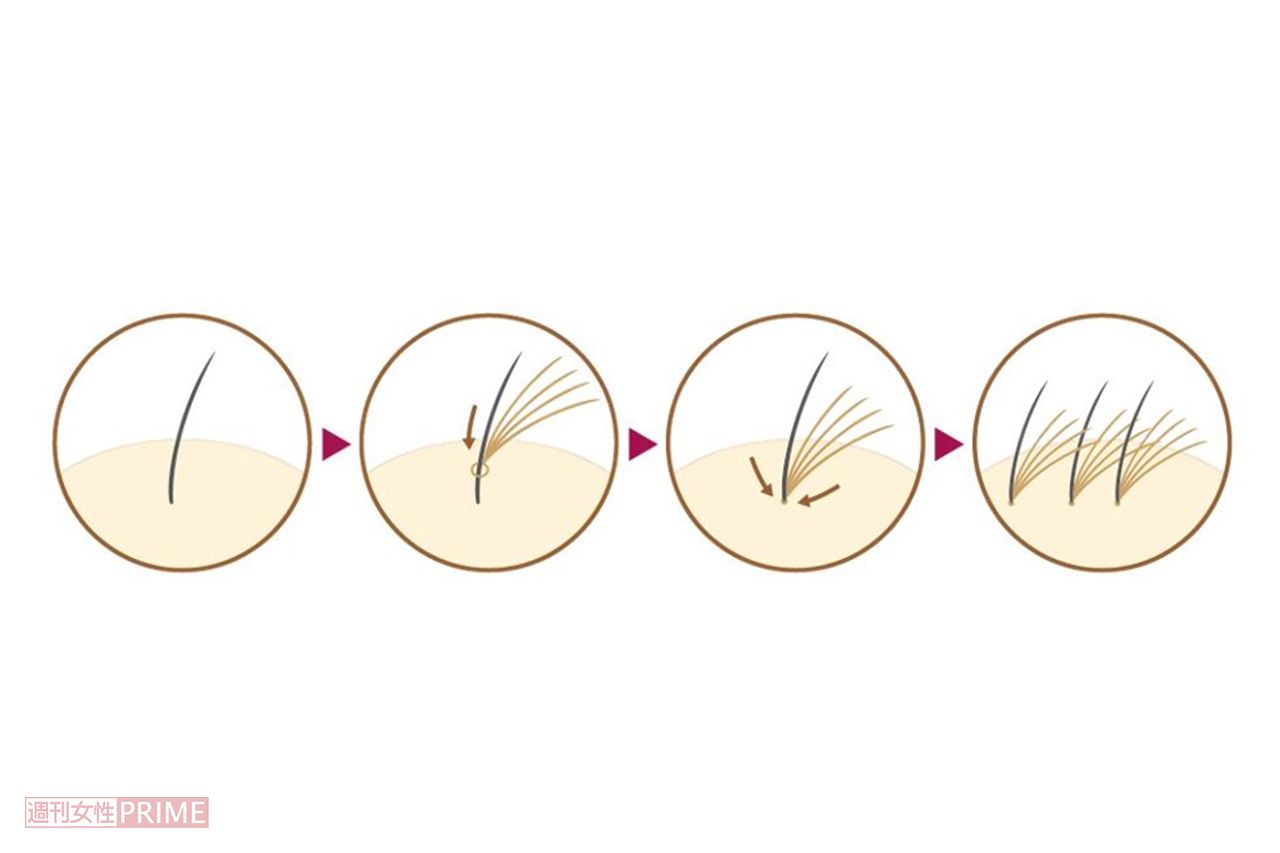 一本の地毛に数本のエクステをつけ、地下の根元に結合させることでボリュームがアップする