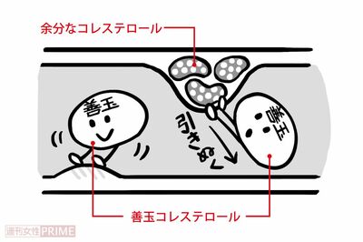 善玉コレステロールが血管を守る！（イラスト／上田英津子）