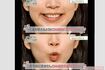 唾液量を復活! リップトレーニングを写真でレクチャー