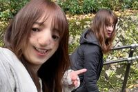 口唇口蓋裂とトリーチャーコリンズ症候群の女性2人が語る“当事者の本音”「“障害は個性”と言われると違…