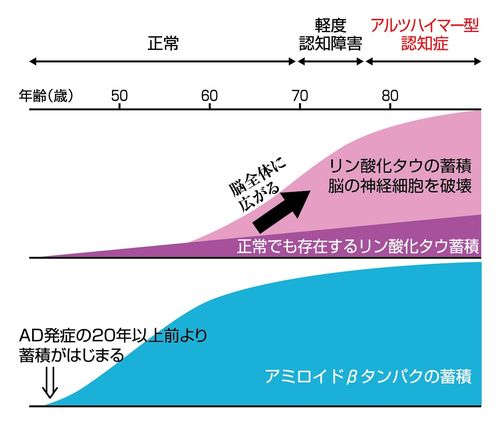 アミロイドβとリン酸化タウはAD発症に密接に関係している（監修／徳田隆彦教授　図／スヤマミヅホ）