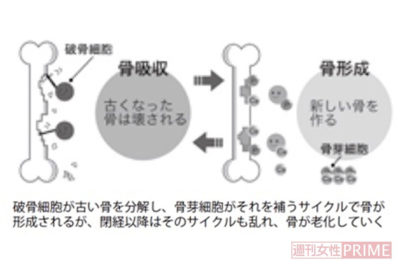 破骨細胞が古い骨を分解し、骨芽細胞がそれを補うサイクルで骨が形成されるが、閉経以降はそのサイクルも乱れ、骨が老化していく